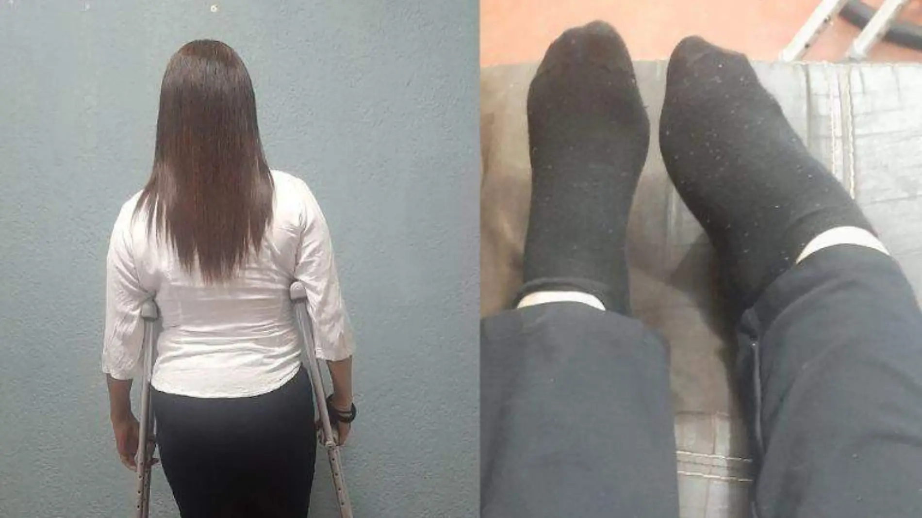 Cynthia lleva 16 años caminando con muletas a causa de una bacteria 